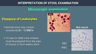 Interpretation of Stool Examination [upl. by Russom]