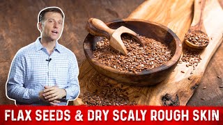 Flaxseed Benefits for Skin amp Symptoms of Linoleic Acid Deficiency – Dr Berg [upl. by Ynabla]