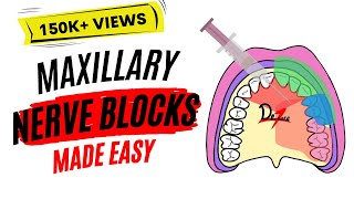 Maxillary Nerve Block Anesthesia For Dental Procedures [upl. by Dnalsor]