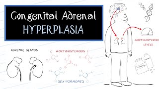 What is Congenital Adrenal Hyperplasia CAH [upl. by Congdon642]