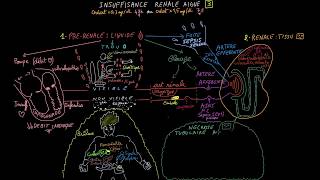 Insuffisance rénale aiguë  Docteur Synapse [upl. by Barnabas]