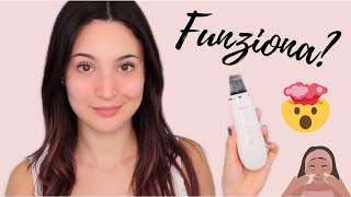 PULIZIA VISO CON GLI ULTRASUONI   REVIEW Scrubber ad ultrasuoni [upl. by Atiuqes895]