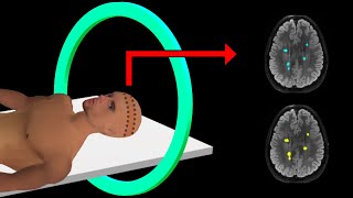 PET Scan  How It Works  Animation [upl. by Imled]