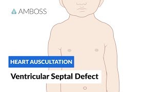 Ventricular Septal Defect VSD  Heart Auscultation  Episode 11 [upl. by Fairbanks855]