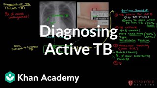 Diagnosing active TB  Infectious diseases  NCLEXRN  Khan Academy [upl. by Gerrilee792]