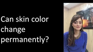 Can your skin tone change from dusky to fair  Dr Aanchal [upl. by Hanala]