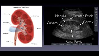 Introduction to Renal Ultrasound [upl. by Deborath713]