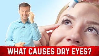 Vitamin A Deficiency – Causes of Dry Eyes Explained by Dr Berg [upl. by Gintz]