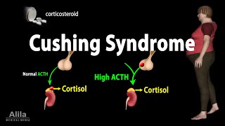 Cushing Syndrome Animation [upl. by Resa321]