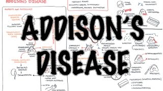 Addisons Disease  Overview clinical features pathophysiology investigations treatment [upl. by Airb603]